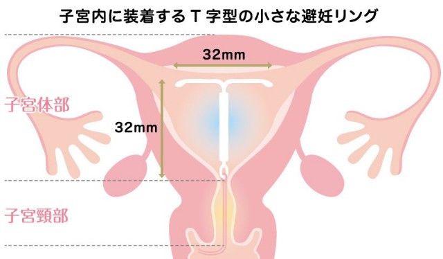 f:id:ruruyasumi:20230317173930j:image f:id:ruruyasumi:20230317173930j:image
