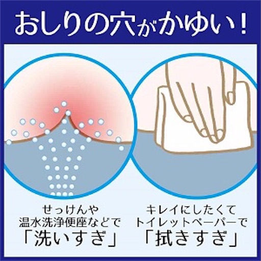 肛門 お尻 が痒い お尻のトラブルはオシリアにお任せ アラサー通信