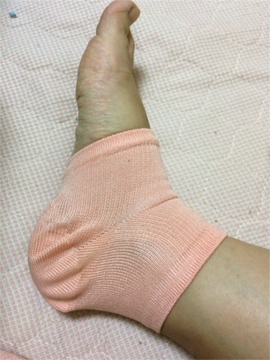 f:id:ryo71724:20161123220512j:image