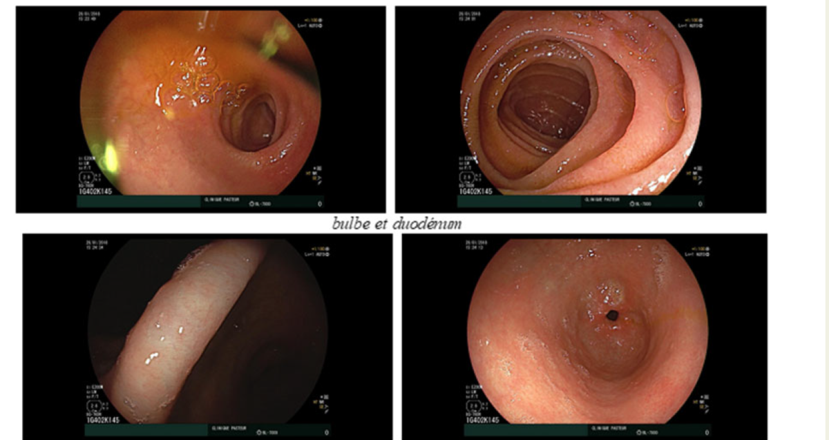 f:id:ryok-kobayashi:20201008234412p:plain