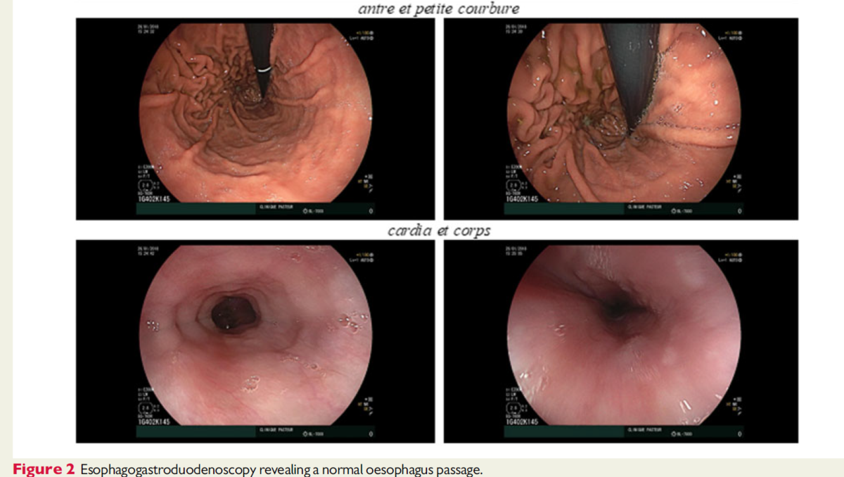 f:id:ryok-kobayashi:20201008234500p:plain