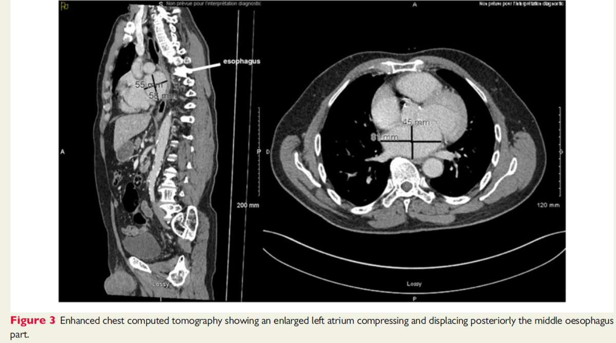 f:id:ryok-kobayashi:20201009000138p:plain