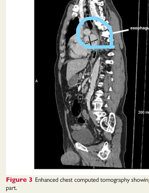 f:id:ryok-kobayashi:20201009000753j:plain
