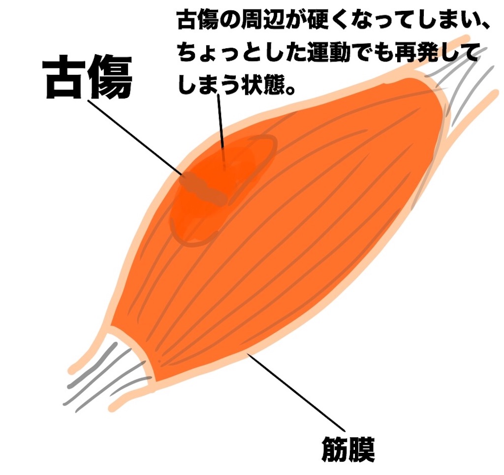 f:id:ryotadohi:20180409051716j:plain