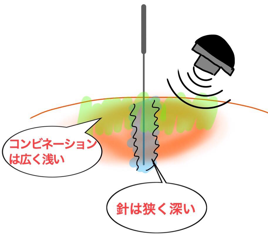 f:id:ryotadohi:20181211115815j:plain