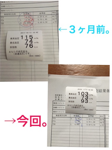 f:id:s-t-s_520-1011-527:20180118094850j:image f:id:s-t-s_520-1011-527:20180118094850j:image