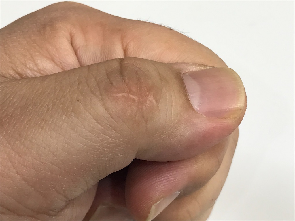 f:id:s2300rr:20200428223944j:image