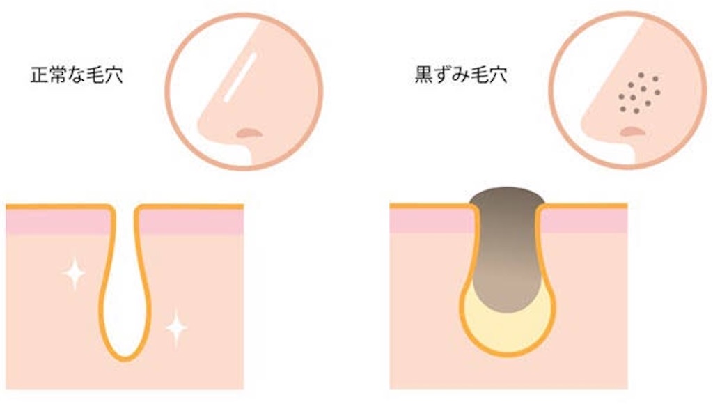 f:id:s_yuru:20210307162624j:image f:id:s_yuru:20210307162624j:image