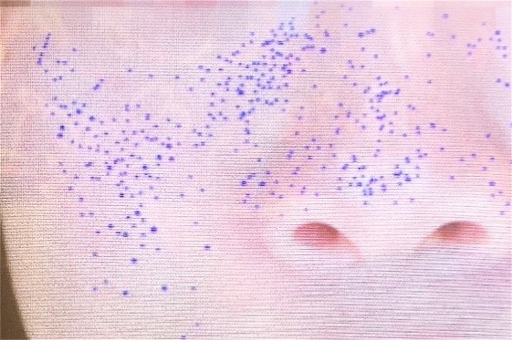 f:id:sa4533:20200208201801j:image f:id:sa4533:20200208201801j:image