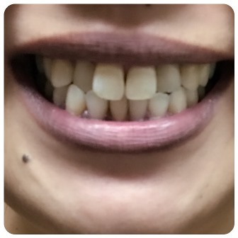 f:id:sachiLab:20170807201009j:plain f:id:sachiLab:20170807201009j:plain
