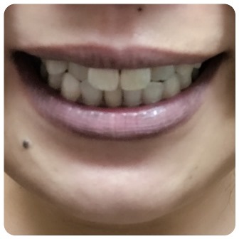 f:id:sachiLab:20170807201041j:plain f:id:sachiLab:20170807201041j:plain