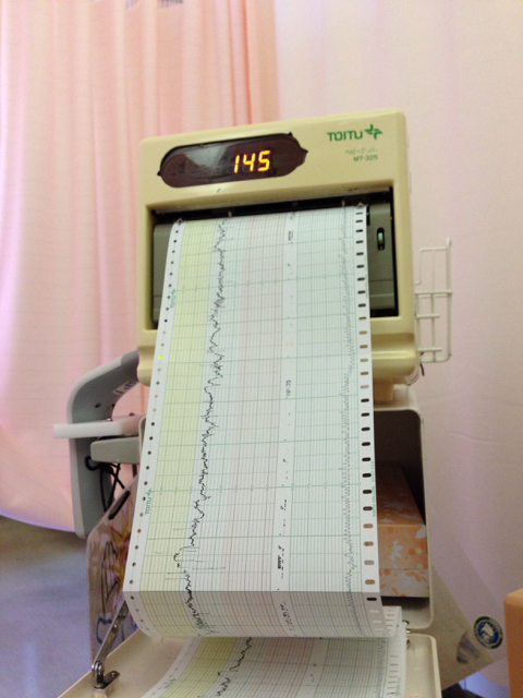 f:id:sachiguronn:20150528123111j:image:h500