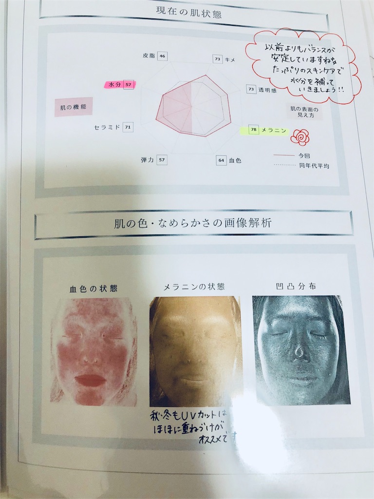 f:id:sae-n-roses:20181109094541j:plain f:id:sae-n-roses:20181109094541j:plain