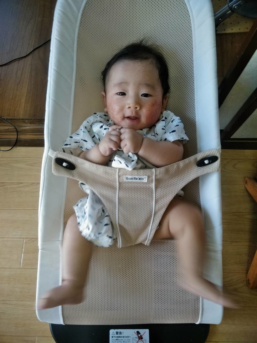 赤ちゃんその２７ 皮膚科で肌荒れが治りました 雇われないで生きる道