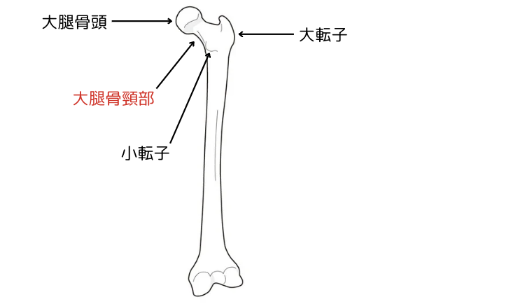 CHANEL 専用ページ 大腿骨看護過程レポート CHANEL 専用ページ 大腿骨看護過程レポート m28060827133_1.jpg