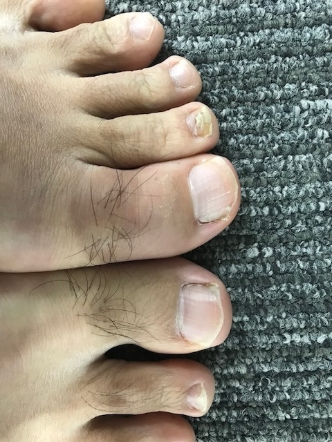 f:id:saitoh_naoki:20180126124646j:plain f:id:saitoh_naoki:20180126124646j:plain