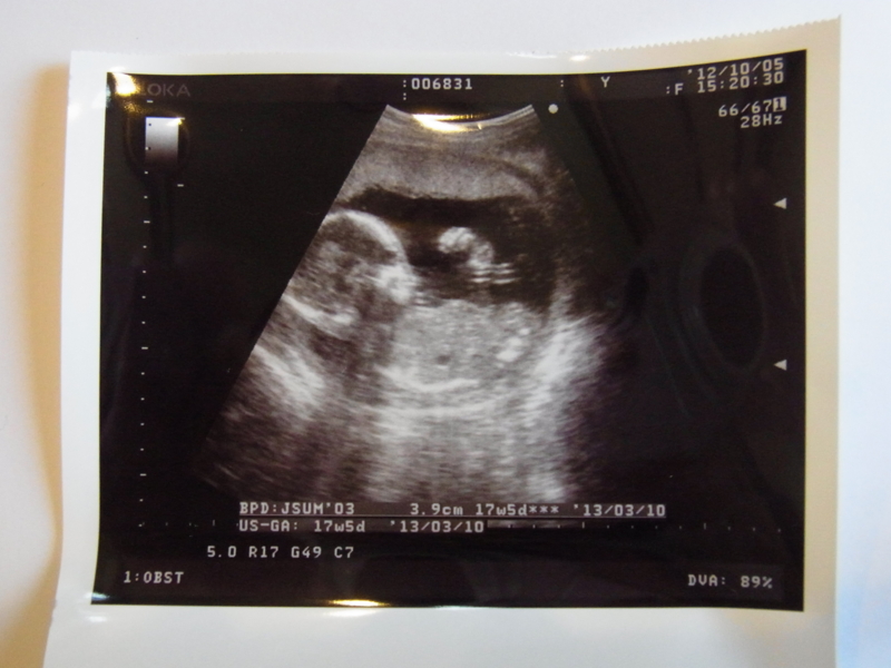 f:id:saitojosanin:20121005163324j:image:w640