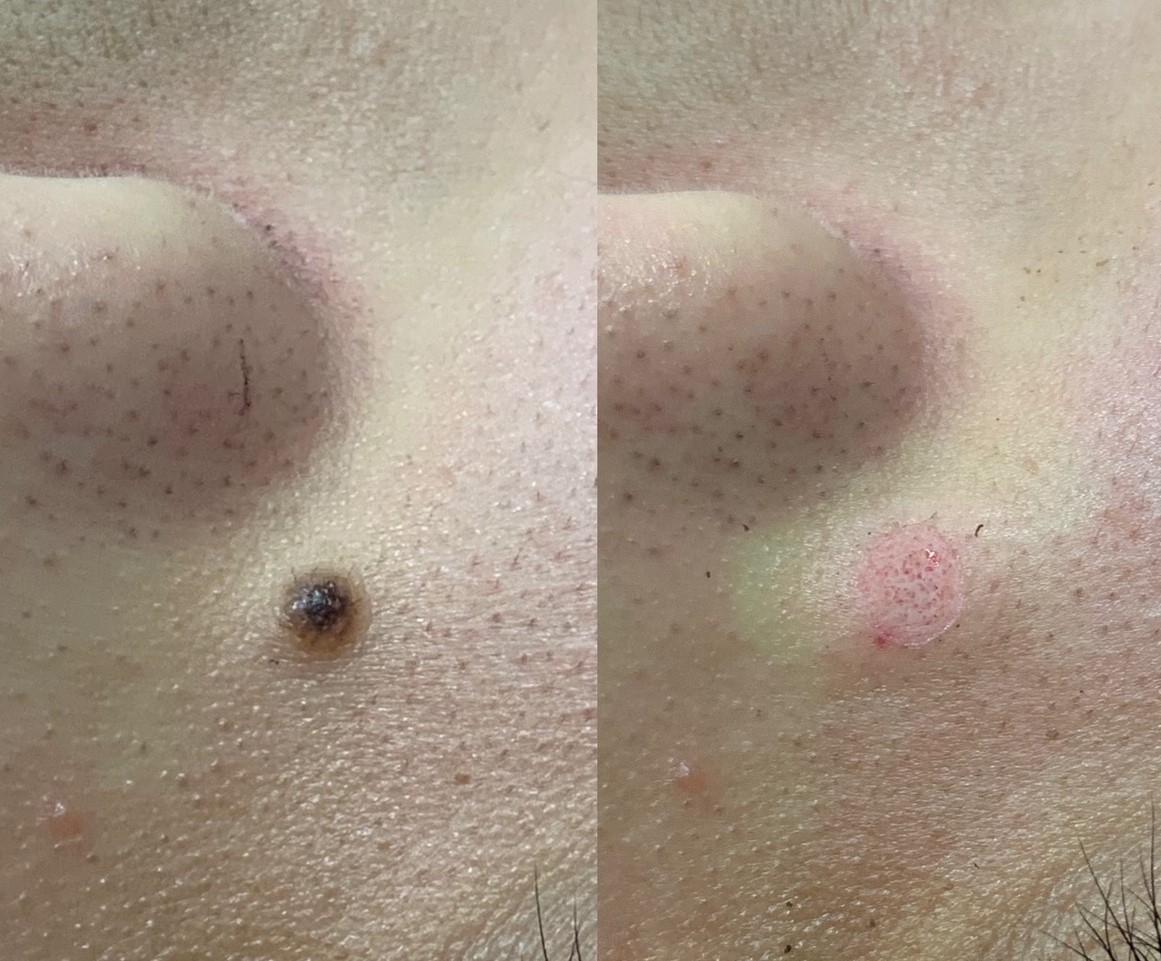 f:id:sakaeclinic:20210302215230j:plain