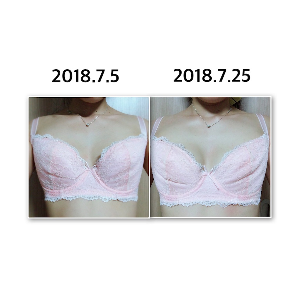f:id:sakura_biyou:20180726183642j:image f:id:sakura_biyou:20180726183642j:image
