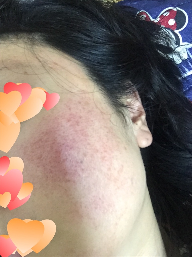 f:id:sakurako-up-up:20170622220241j:image