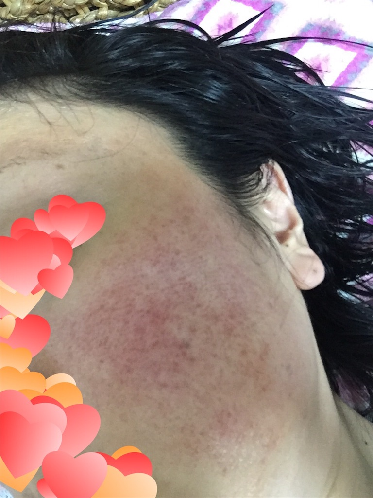 f:id:sakurako-up-up:20170622220540j:image