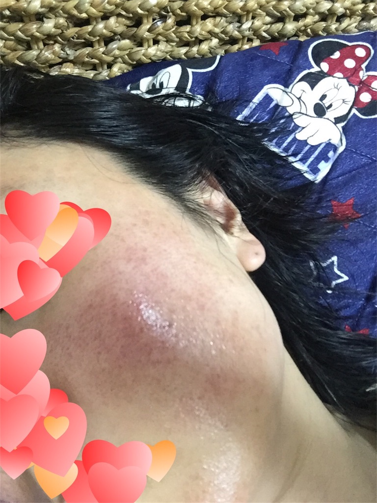 f:id:sakurako-up-up:20170622223252j:image