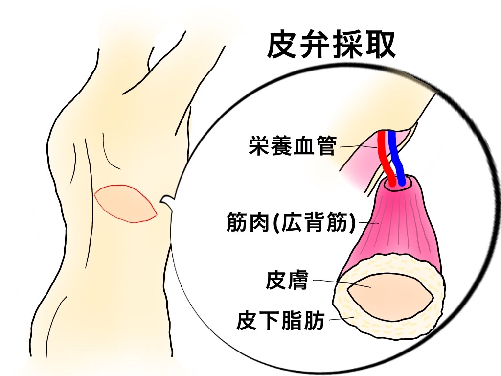 f:id:sakusaku-happy:20190704124023j:image