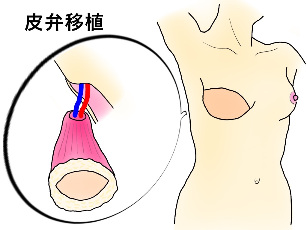 f:id:sakusaku-happy:20190704124025j:image