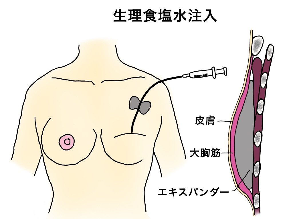 f:id:sakusaku-happy:20190704191821j:image