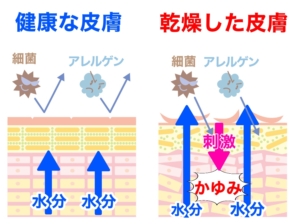 f:id:sakusaku-happy:20191126200302j:plain