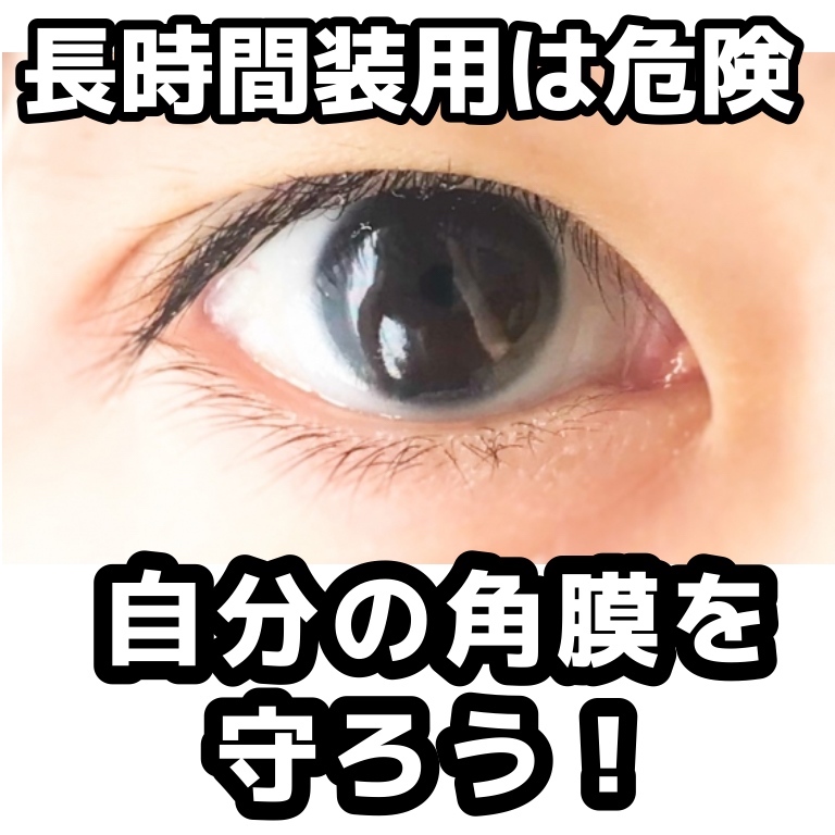 コンタクトレンズは帰宅したらすぐに外そう 酸欠で角膜の細胞が死ぬ そして再生しないらしい さくさくの日常