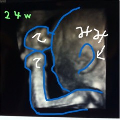 f:id:samiya33:20120521210123j:image