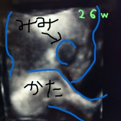 f:id:samiya33:20120521210211j:image