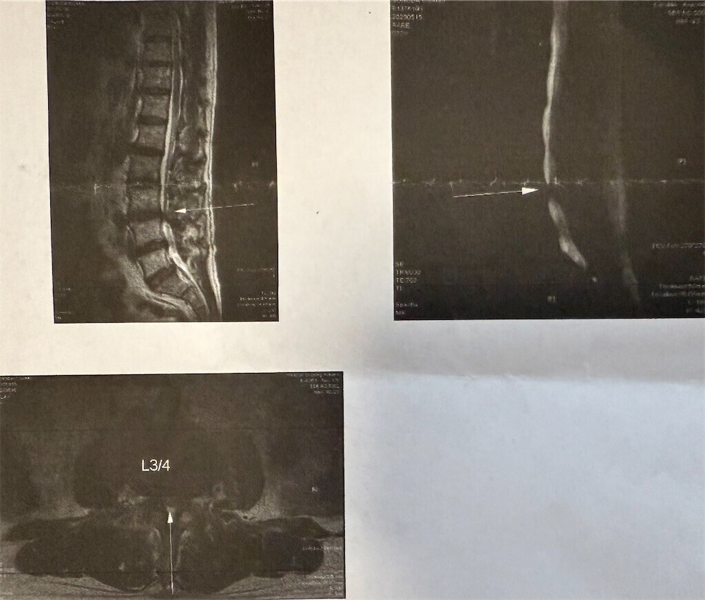 f:id:samso:20250523230155j:image f:id:samso:20250523230155j:image