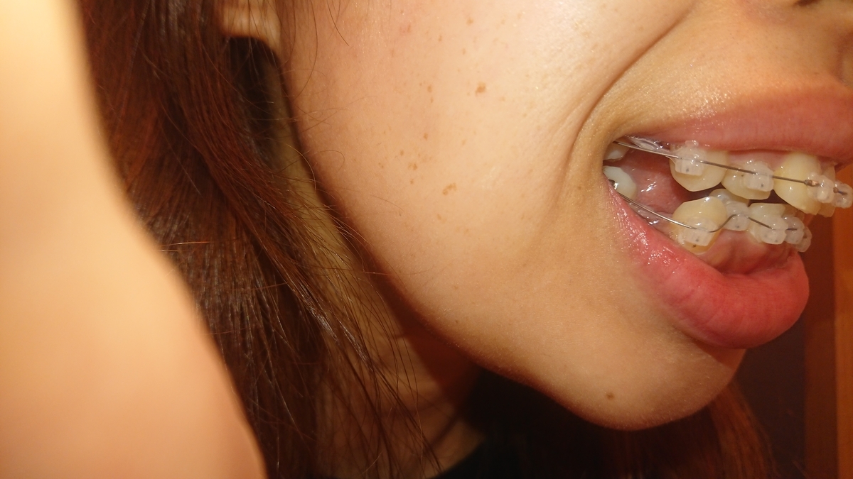 f:id:sanshouuuo:20210827182311j:plain
