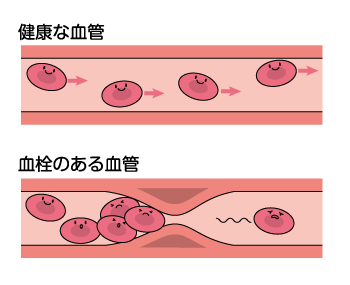 f:id:sanzohc:20170125233220g:plain