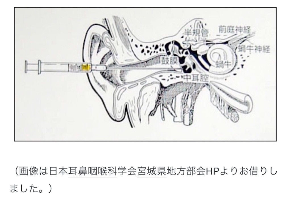 f:id:sasa-oto:20200701140353j:image f:id:sasa-oto:20200701140353j:image