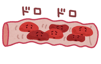 血液ドロドロで血管が詰まりそうなイラスト