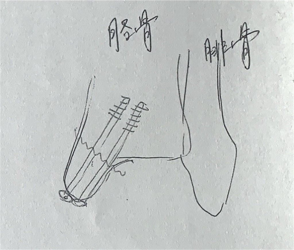 f:id:satomies:20201210213425j:image:w200