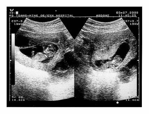 f:id:satyagraha08:20130805132256j:image:left f:id:satyagraha08:20130805132256j:image:left