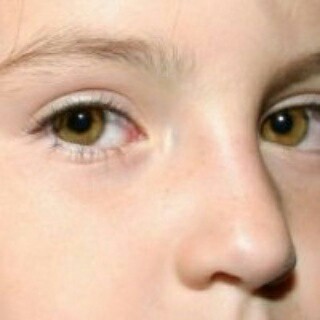 f:id:sawabihada:20170320233139j:image f:id:sawabihada:20170320233139j:image