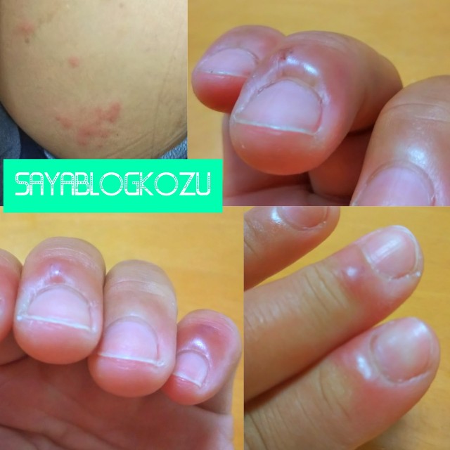 f:id:sayablogkozu:20210809082325j:image f:id:sayablogkozu:20210809082325j:image