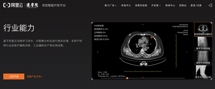 Alibaba Cloud(阿里云)のCT画像解析ソリューション(https://cn.aliyun.com/)