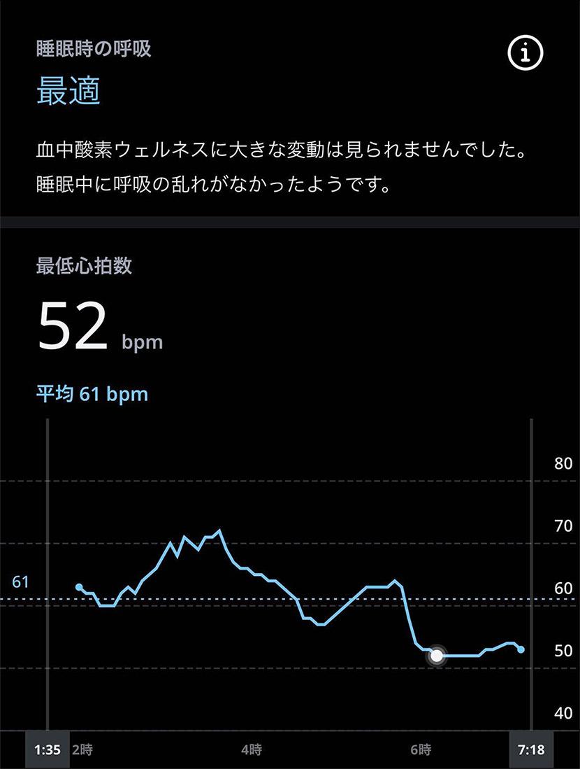 「睡眠」メニューから確認できる計測データ