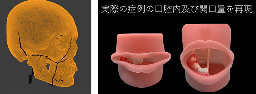 Transmitting VR and AR images over a 5G network to support dental implant surgery