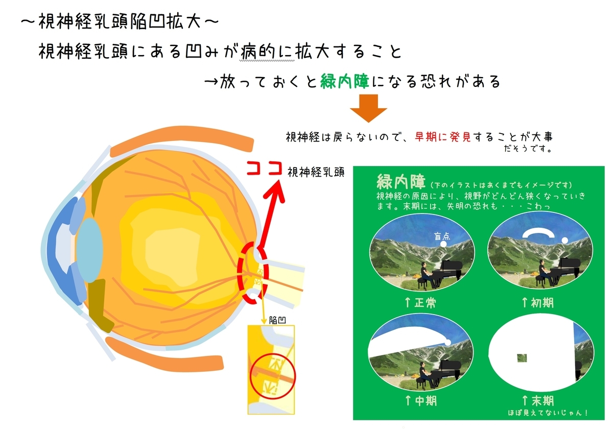 f:id:schunchi2007:20190927054246j:plain f:id:schunchi2007:20190927054246j:plain