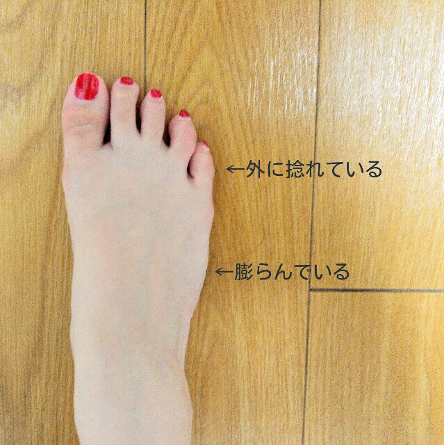 f:id:scude:20170730180624j:image f:id:scude:20170730180624j:image