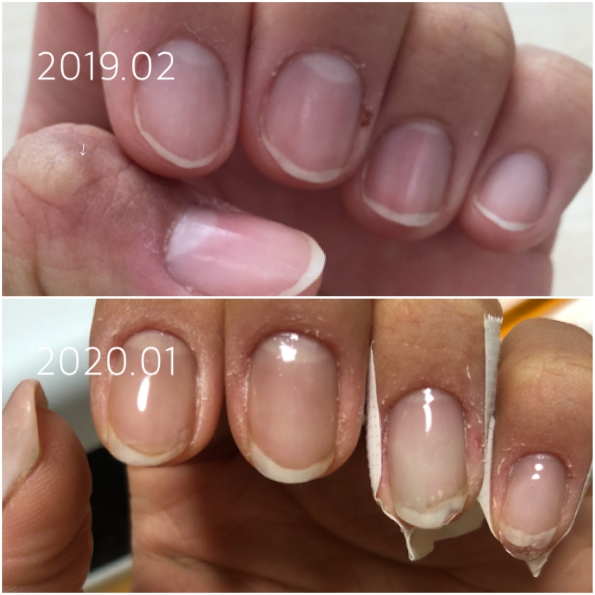 爪 白いところ 肝臓