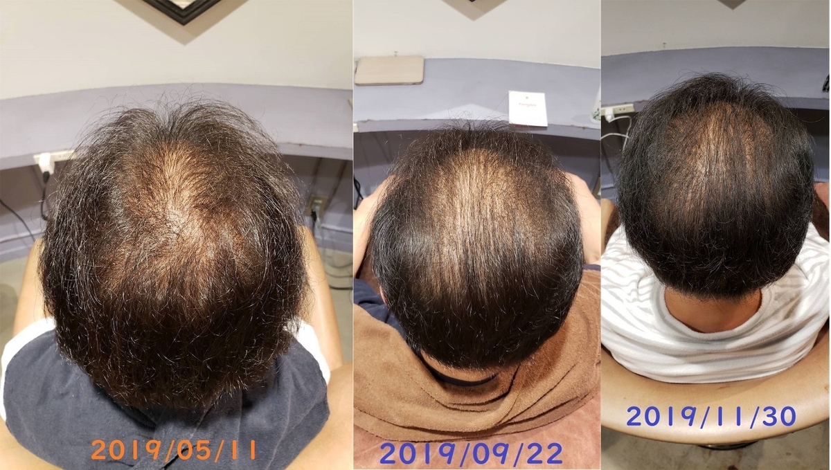 f:id:sept-cloche:20200401224938j:plain f:id:sept-cloche:20200401224938j:plain