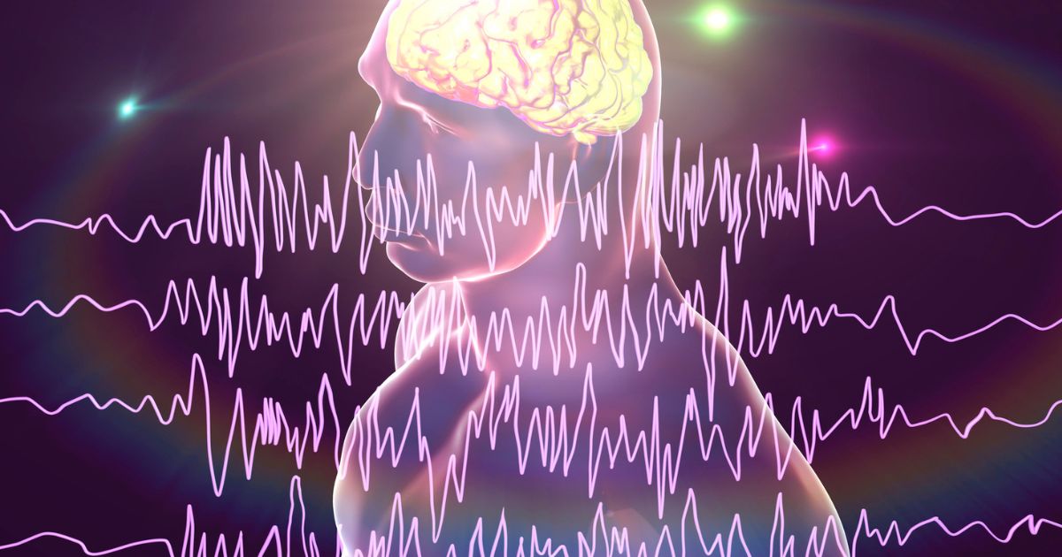 脳波のイメージ
